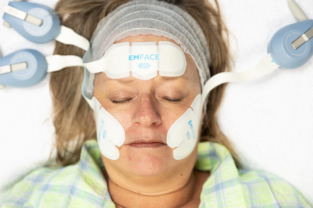 Close up of a woman undergoing Emface near Germantown, TN