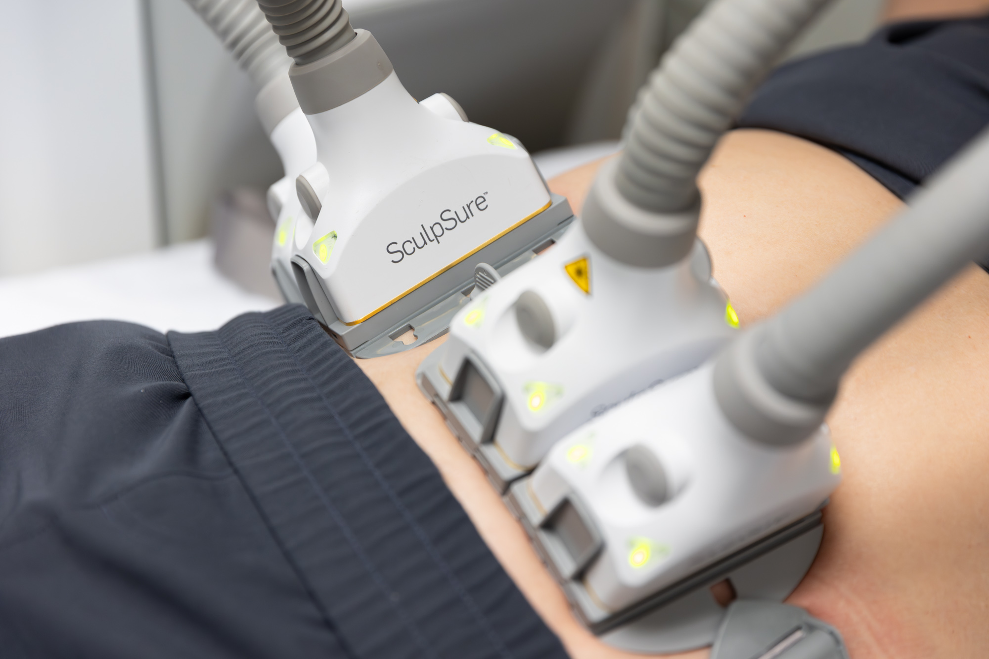 SculpSure performing body shaping in Memphis,TN