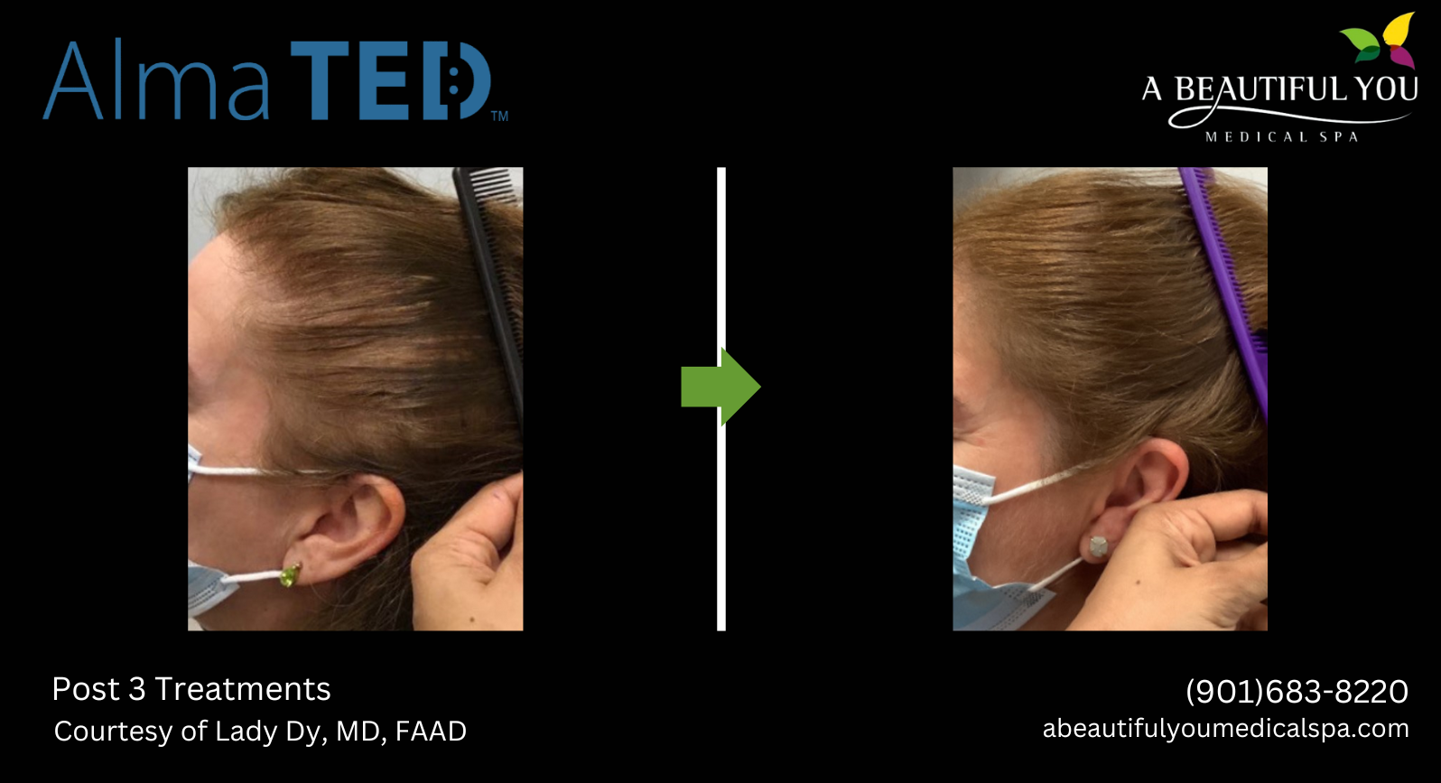 TED Hair Restoration