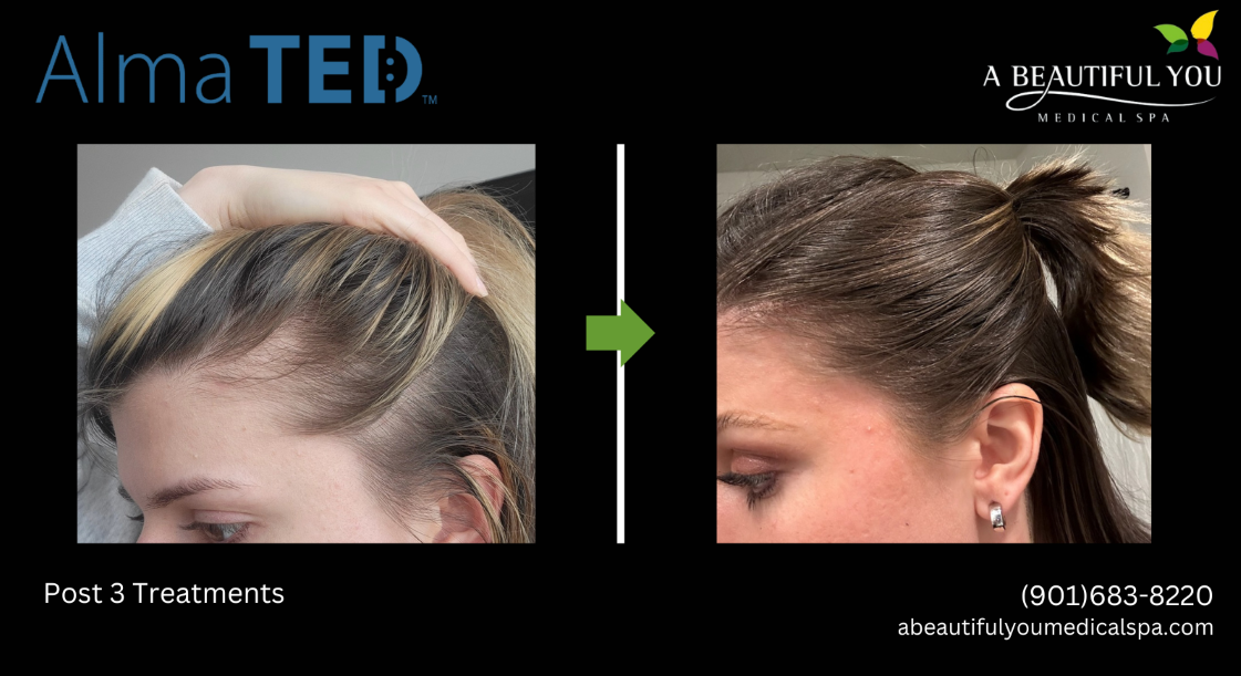 TED Hair Restoration