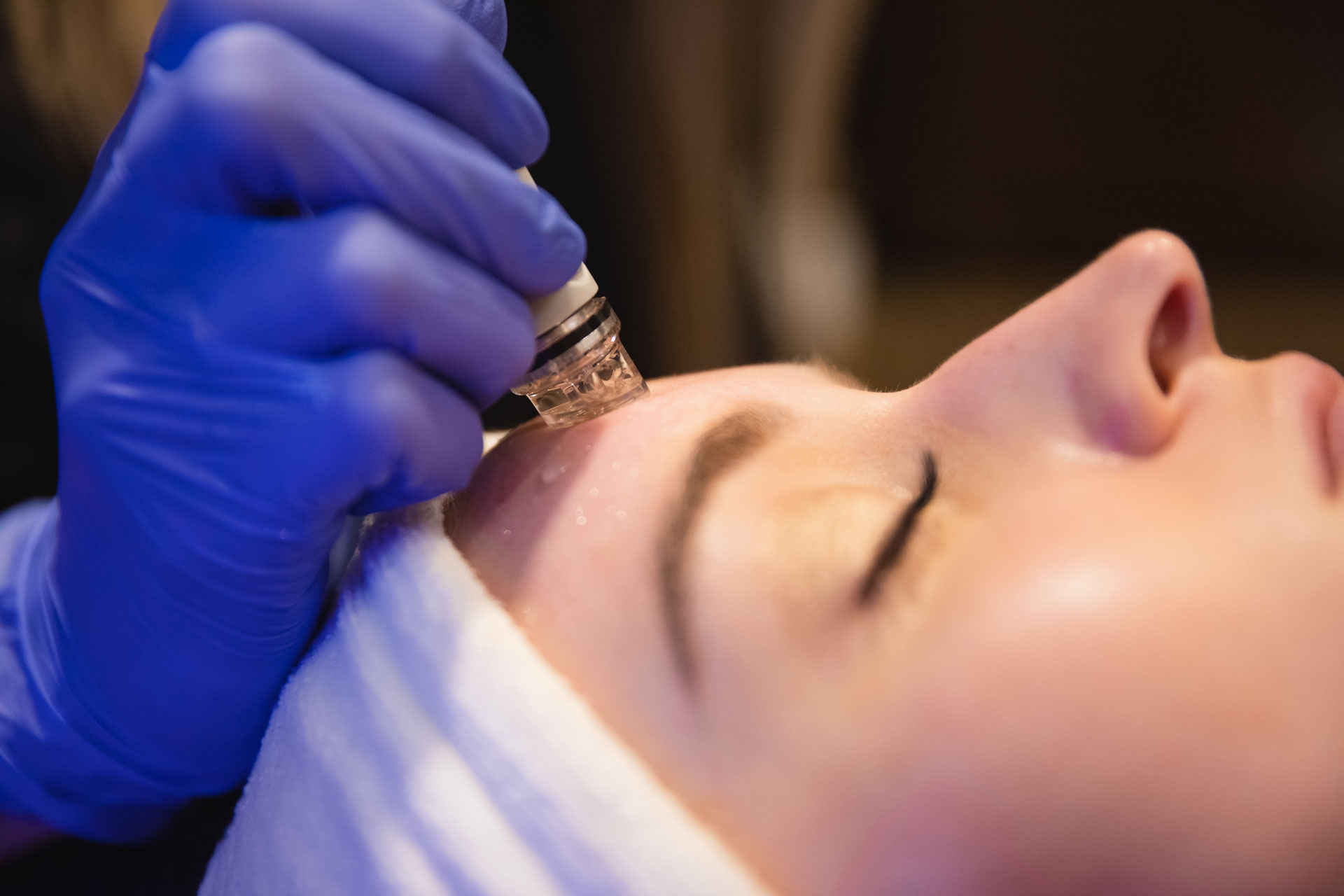 Close up of a woman getting a HydraFacial for skin care in Memphis